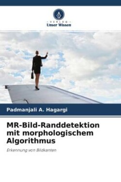 MR-Bild-Randdetektion mit morphologischem Algorithmus