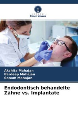 Endodontisch behandelte Zähne vs. Implantate