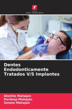 Dentes Endodonticamente Tratados V/S Implantes