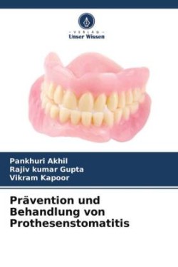 Prävention und Behandlung von Prothesenstomatitis