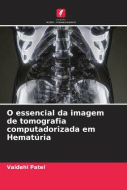 O essencial da imagem de tomografia computadorizada em Hematúria
