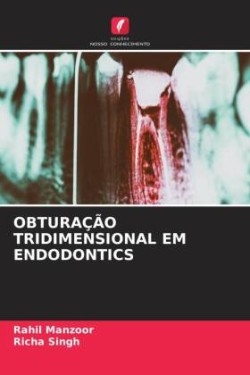 OBTURAÇÃO TRIDIMENSIONAL EM ENDODONTICS