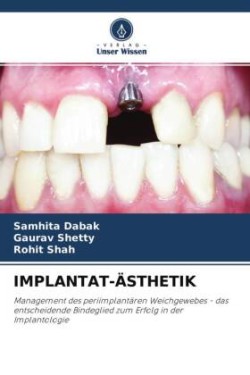 IMPLANTAT-ÄSTHETIK