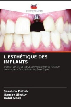 L'ESTHÉTIQUE DES IMPLANTS