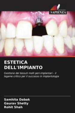 ESTETICA DELL'IMPIANTO