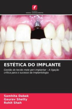 ESTÉTICA DO IMPLANTE