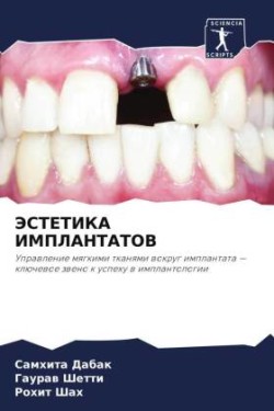 JeSTETIKA IMPLANTATOV