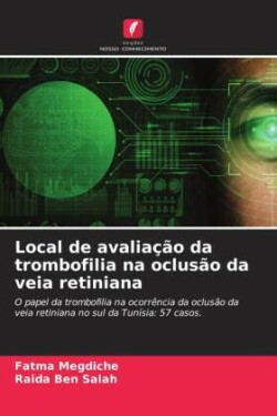 Local de avaliação da trombofilia na oclusão da veia retiniana