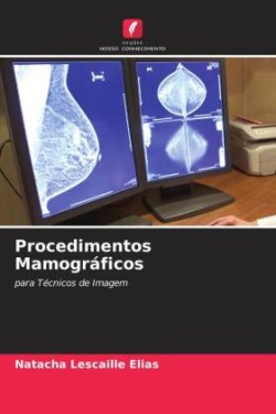 Procedimentos Mamográficos