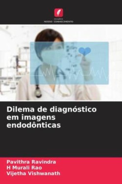 Dilema de diagnóstico em imagens endodônticas