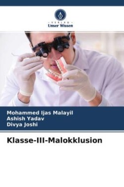 Klasse-III-Malokklusion