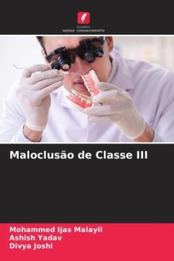 Maloclusão de Classe III