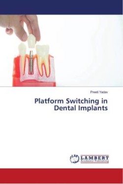 Platform Switching in Dental Implants