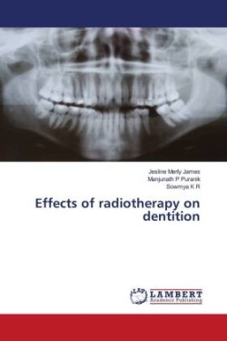 Effects of radiotherapy on dentition