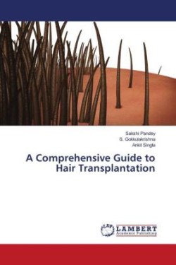 A Comprehensive Guide to Hair Transplantation