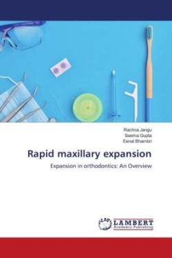 Rapid maxillary expansion