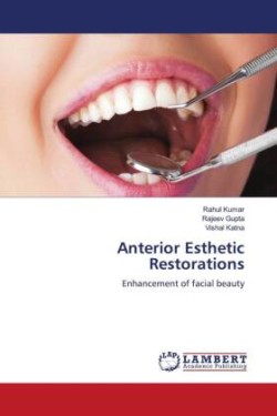 Anterior Esthetic Restorations