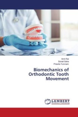 Biomechanics of Orthodontic Tooth Movement