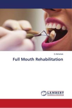 Full Mouth Rehabilitation