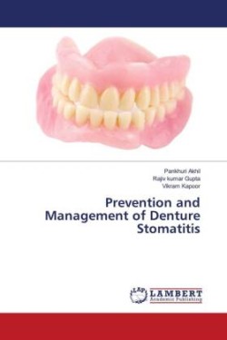 Prevention and Management of Denture Stomatitis