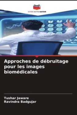 Approches de débruitage pour les images biomédicales