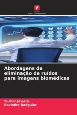 Abordagens de eliminação de ruídos para imagens biomédicas