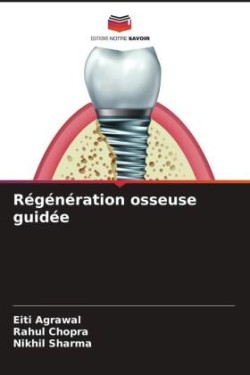 Régénération osseuse guidée