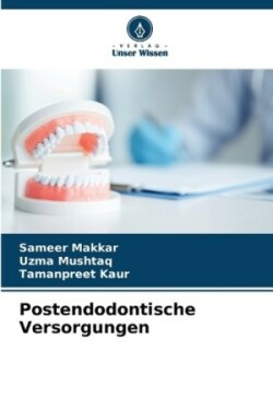 Postendodontische Versorgungen