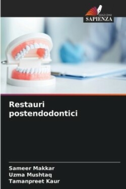 Restauri postendodontici