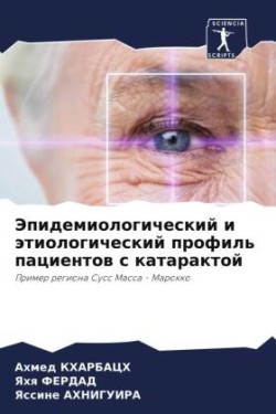 Jepidemiologicheskij i ätiologicheskij profil' pacientow s kataraktoj