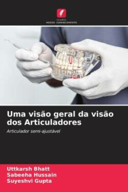 Uma visão geral da visão dos Articuladores