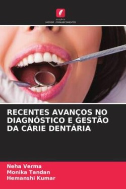 RECENTES AVANÇOS NO DIAGNÓSTICO E GESTÃO DA CÁRIE DENTÁRIA