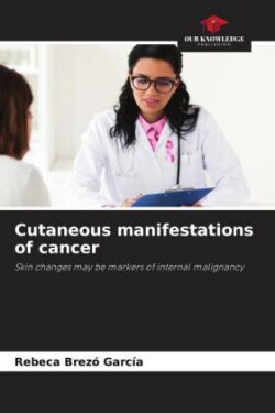 Cutaneous manifestations of cancer