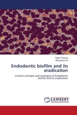 Endodontic biofilm and its eradication