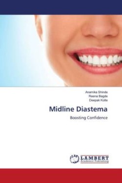 Midline Diastema