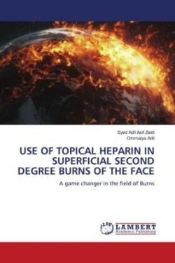 USE OF TOPICAL HEPARIN IN SUPERFICIAL SECOND DEGREE BURNS OF THE FACE