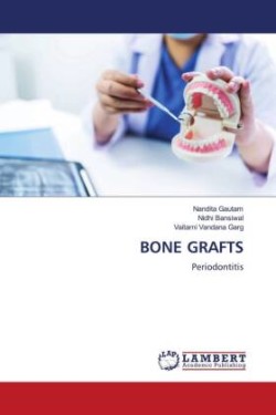 BONE GRAFTS