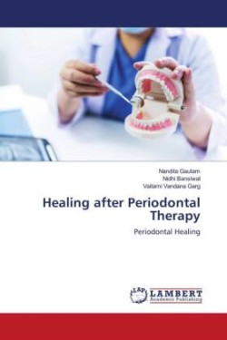 Healing after Periodontal Therapy