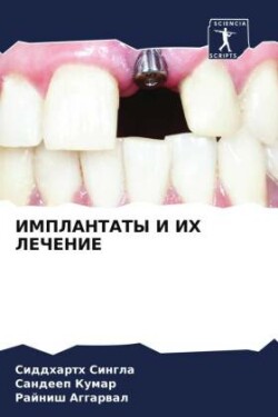 IMPLANTATY I IH LEChENIE