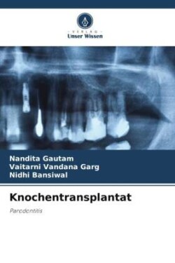 Knochentransplantat