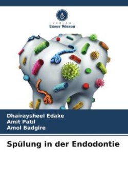 Spülung in der Endodontie