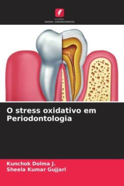 O stress oxidativo em Periodontologia