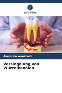 Versiegelung von Wurzelkanälen