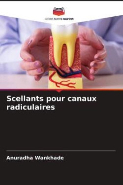 Scellants pour canaux radiculaires