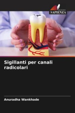 Sigillanti per canali radicolari