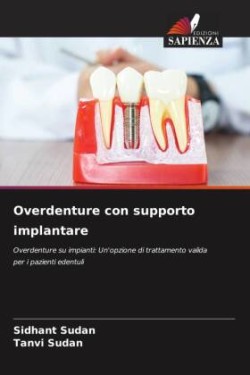 Overdenture con supporto implantare