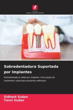 Sobredentadura Suportada por Implantes