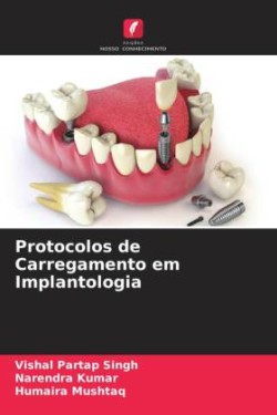 Protocolos de Carregamento em Implantologia