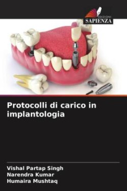 Protocolli di carico in implantologia