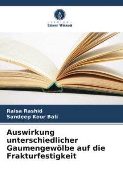 Auswirkung unterschiedlicher Gaumengewölbe auf die Frakturfestigkeit